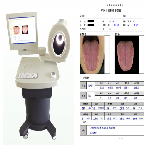 中醫(yī)舌診圖像分析系統(tǒng)（臺(tái)車(chē)式）